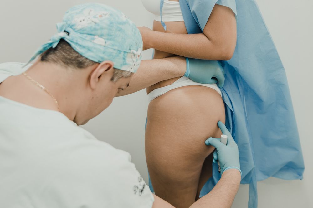 extraccion biopolimeros