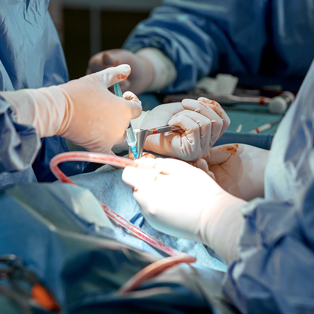 3 Menor Sangrado.jpg